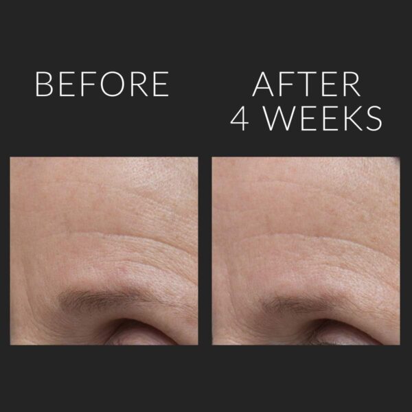 Kate Somerville DermalQuench Liquid Lift + Retinol Advanced Resurfacing Treatment 71g - Image 5