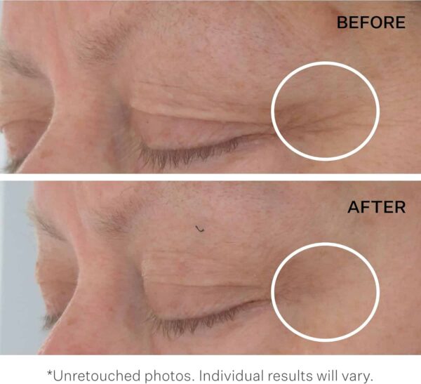 StriVectin Hyaluronic Tripeptide Gel Cream for Eyes 15ml - Image 5