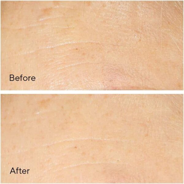 Murad The Derm Report Minimising Lines and Wrinkles 60ml Cleansing Cream + 3ml Wrinkle Corrector + 10ml Serum + 15ml Night Cream - Image 11