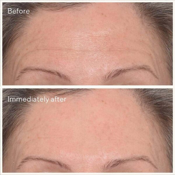 Murad The Derm Report Minimising Lines and Wrinkles 60ml Cleansing Cream + 3ml Wrinkle Corrector + 10ml Serum + 15ml Night Cream - Image 4