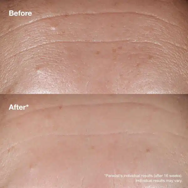 Clinique Smart Clinical Repair Wrinkle Correcting Serum 50ml - Image 4