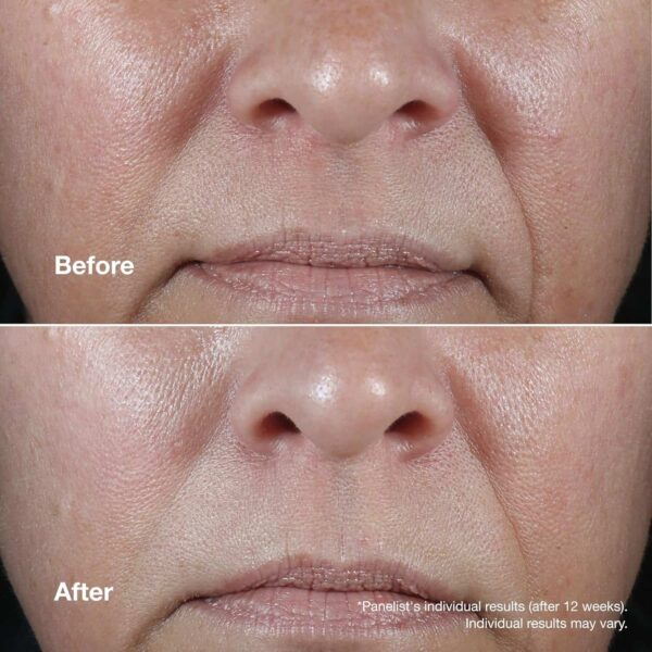 Clinique Smart Clinical Repair Wrinkle Correcting Rich Cream 50ml - Image 4