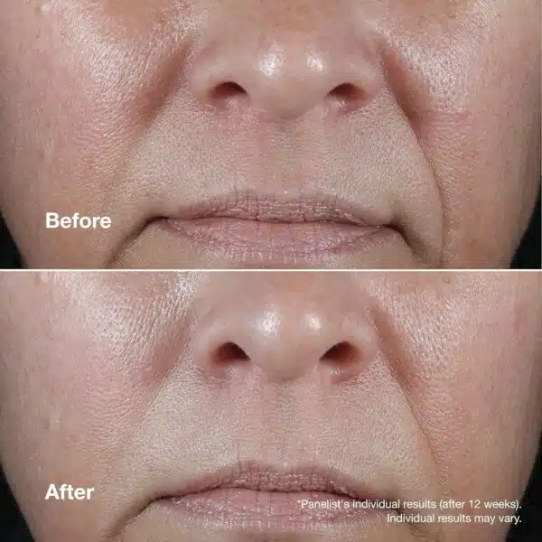 Clinique Smart Clinical Repair Wrinkle Correcting Rich Cream 50ml - Image 4